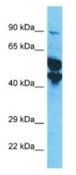 KRT33A Rabbit anti-Human, Polyclonal, Novus Biologicals 100 &mu;g; Unconjugated:Antibodies,